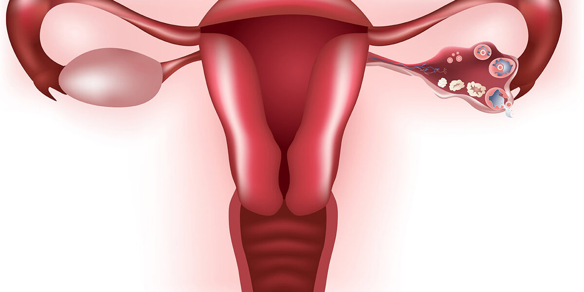 جماليات فينوس هيل