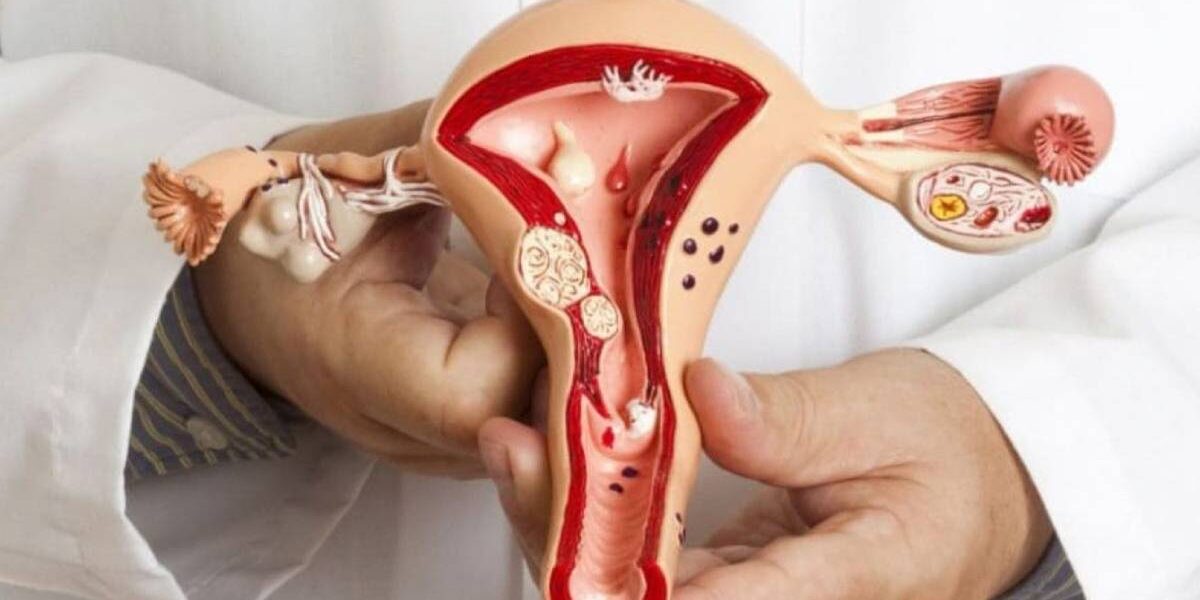 Vulva- und Vagina-Erkrankungen